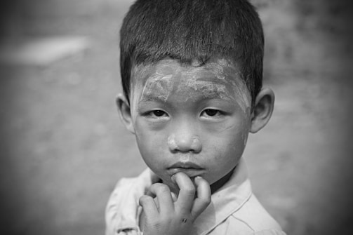 A young child with a serious expression on their face, touching their lips with fingers. Their skin appears to have a noticeable white substance applied in patches.