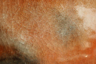 human skin