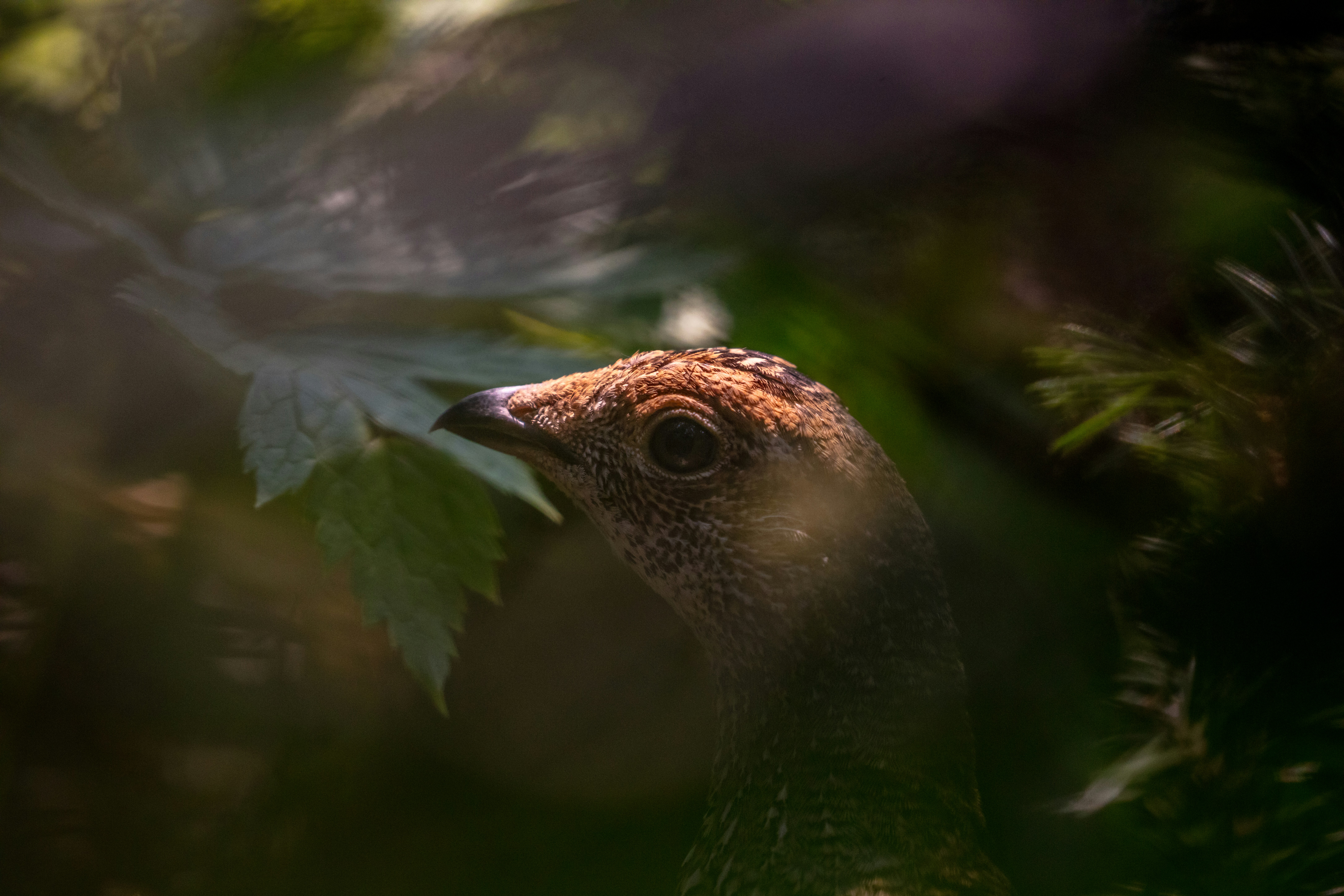 Laser Peripheral Iridotomy Aftercare Tips Eye Surgery Guide