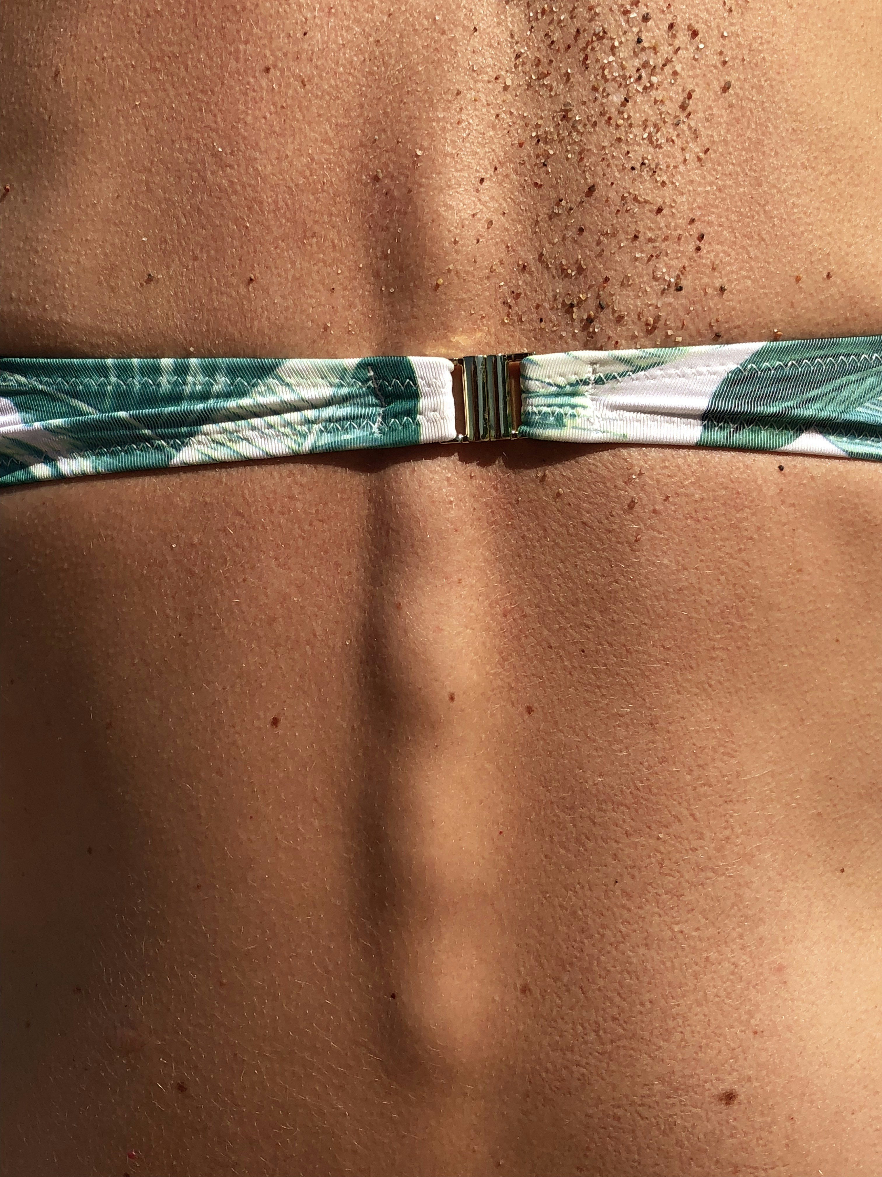 Microneedling Stomach