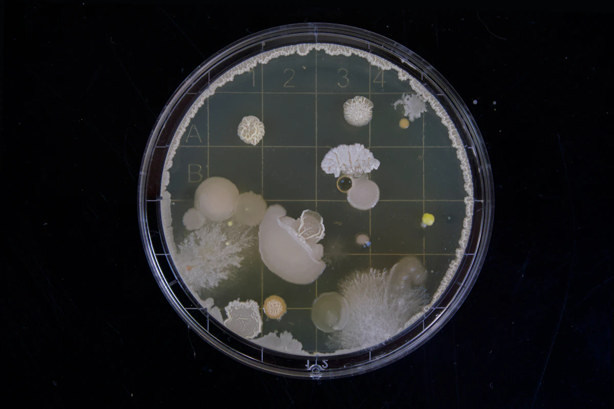 Colonies de bactéries et moisissures dans une boîte de Petri