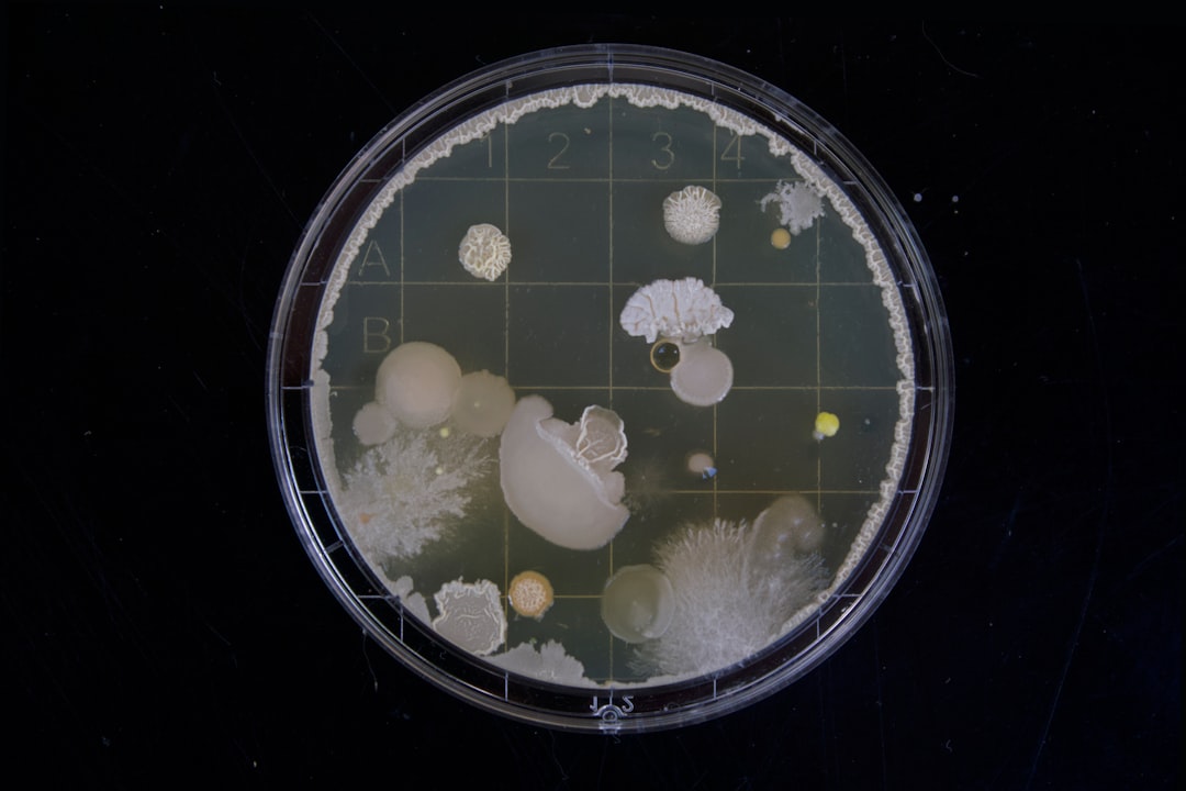 scope image, A friend of mine had to do some bacteria samples during her bachelor thesis. When i saw those i was instant