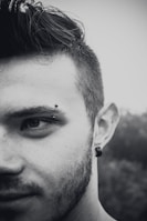 Patient's jawline before and after mandibular contouring procedure.