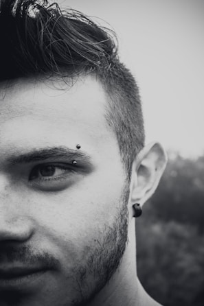 Patient's jawline before and after mandibular contouring procedure.