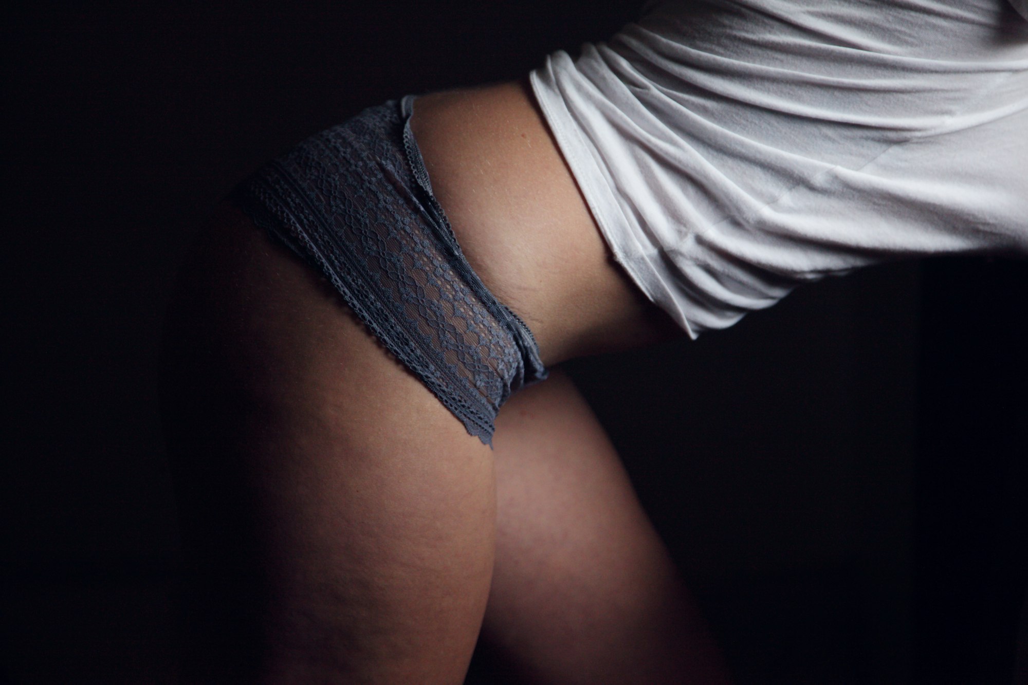 Natural portrait of hips and thighs of a twenty-five year old woman showing cellulite and stretch marks.