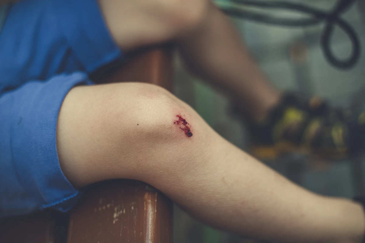 Step-by-Step Guide Through the Personal Injury Claims Process