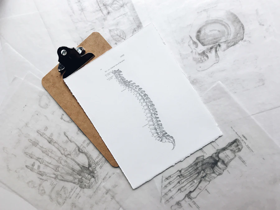 Sciatica and referred pain