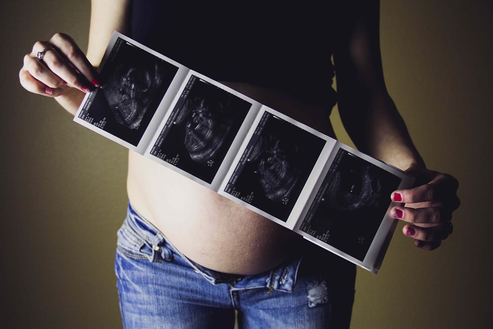woman holding ultrasound results