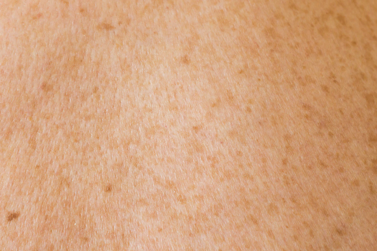 Close-up of skin texture, representing fungal skin infection assessment