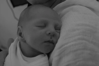 A tender moment of a baby peacefully sleeping after surgery, wrapped in a soft blanket.