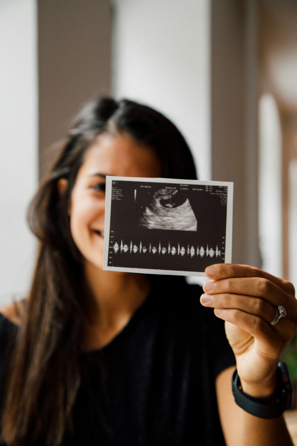 woman showing ultrasound result