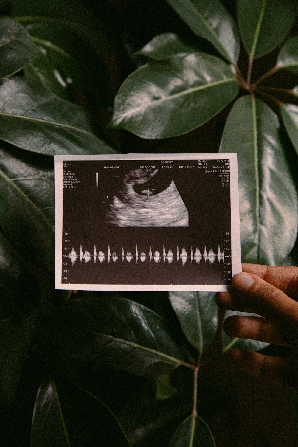 person holding ultra sound result