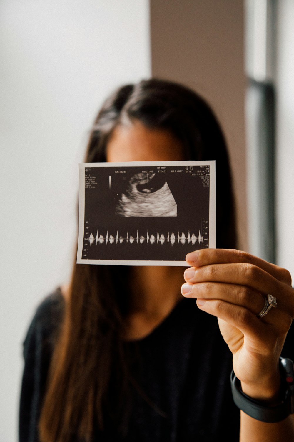 woman holding sonograph
