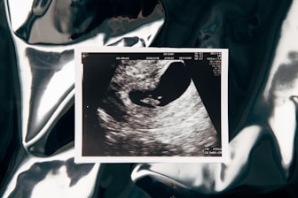 A printed ultrasound scan placed on a shiny, crumpled surface that reflects light. The scan shows a developing fetus within the womb, displaying typical ultrasound colors in shades of black, white, and gray.
