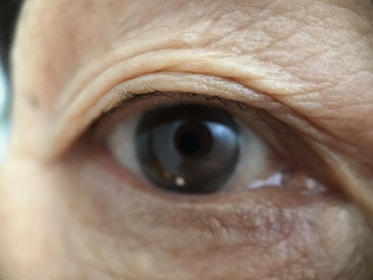 A close-up image of an eye with visible details of the wrinkles and textures of the surrounding skin. The eye is open, revealing the iris and pupil with strong lighting reflecting off the surface.