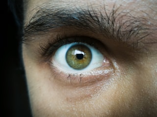 A detailed close-up of a human eye with hazel or green iris, surrounded by natural skin textures and eyebrow hair. The image provides a sharp and clear view of the eye's intricate details, including the pupil and reflections in the cornea.