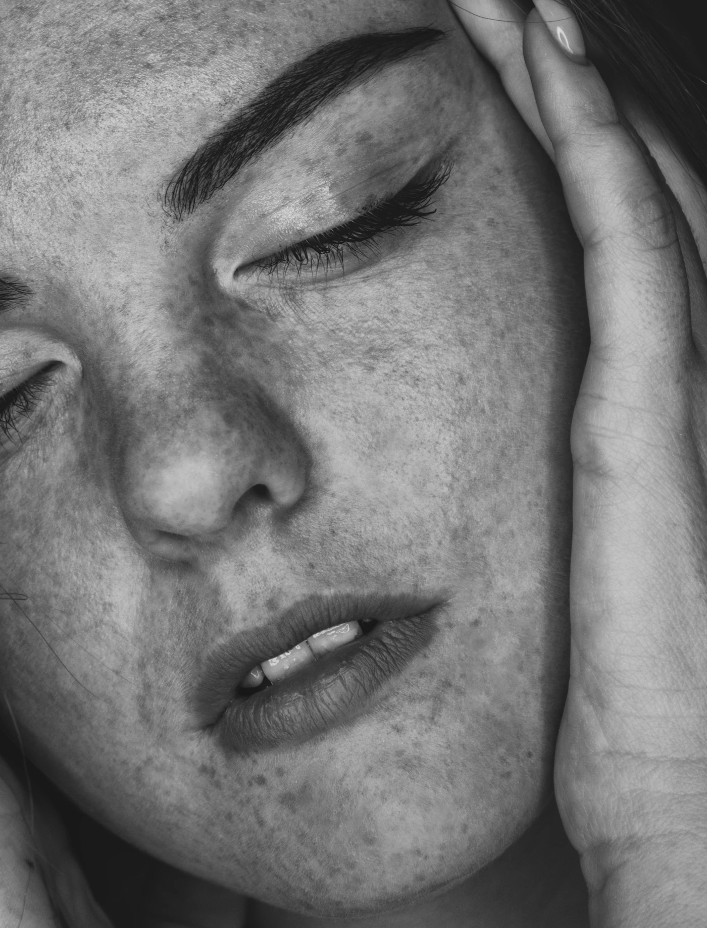 Close-up portrait of a person with clear, smooth-textured skin, representing the refined complexion associated with a completed CO2 laser treatment course