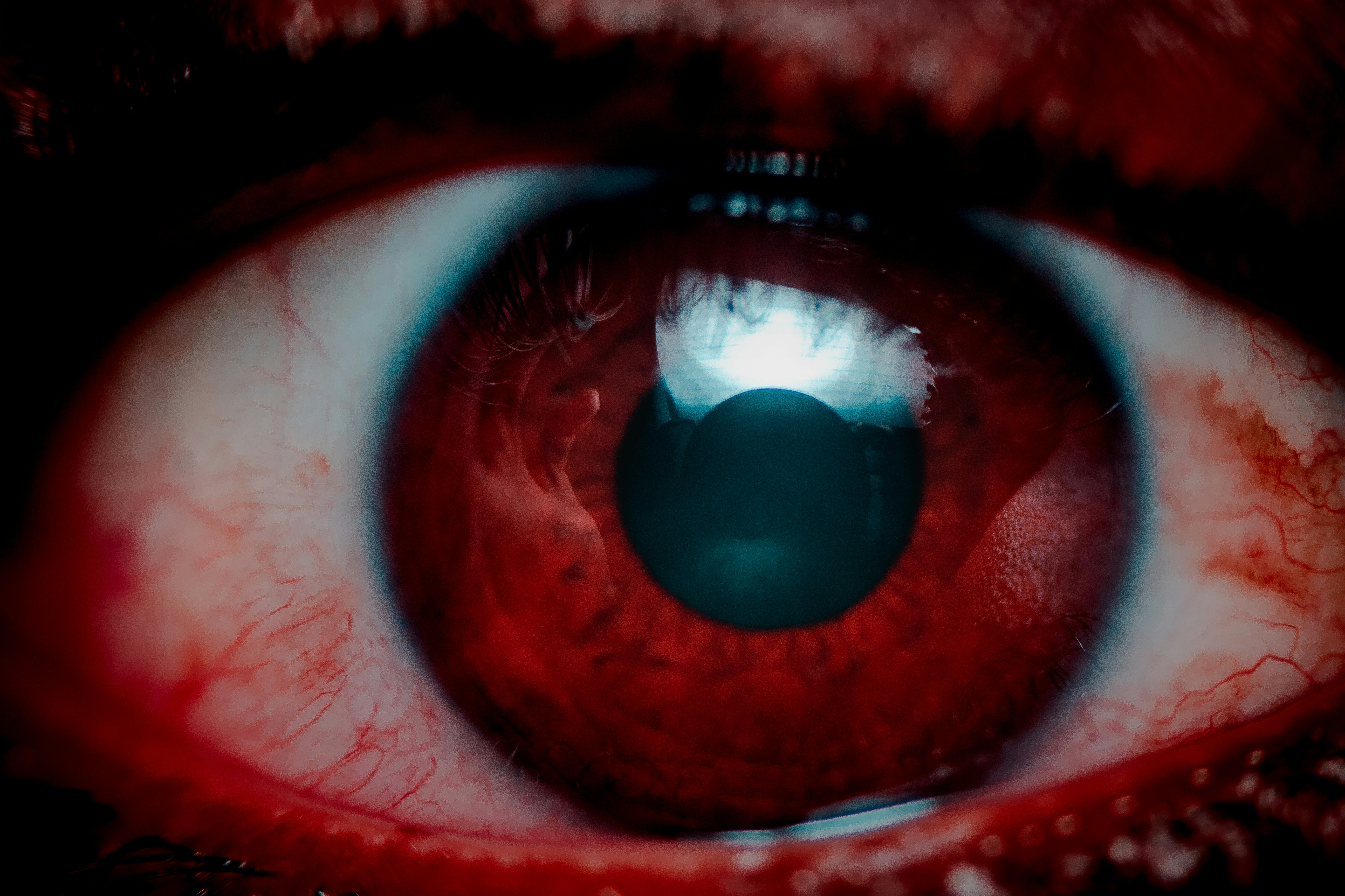 Eye Issues and Liver Health