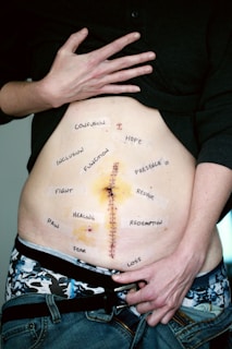 A person's torso with a prominent vertical scar down the middle of the abdomen. There are various words written around the scar, such as confusion, hope, inclusion, function, presence, fight, repair, pain, healing, redemption, fear, and loss. The person is holding up their shirt to reveal the scar and the words, and they are wearing jeans and patterned underwear.