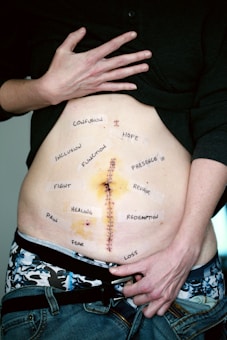 A person's torso with a prominent vertical scar down the middle of the abdomen. There are various words written around the scar, such as confusion, hope, inclusion, function, presence, fight, repair, pain, healing, redemption, fear, and loss. The person is holding up their shirt to reveal the scar and the words, and they are wearing jeans and patterned underwear.