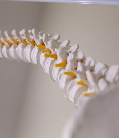 A detailed anatomical model of a human spine, showcasing the vertebrae with intervertebral discs highlighted in yellow. The model is arranged in a slightly curved position against a neutral background.