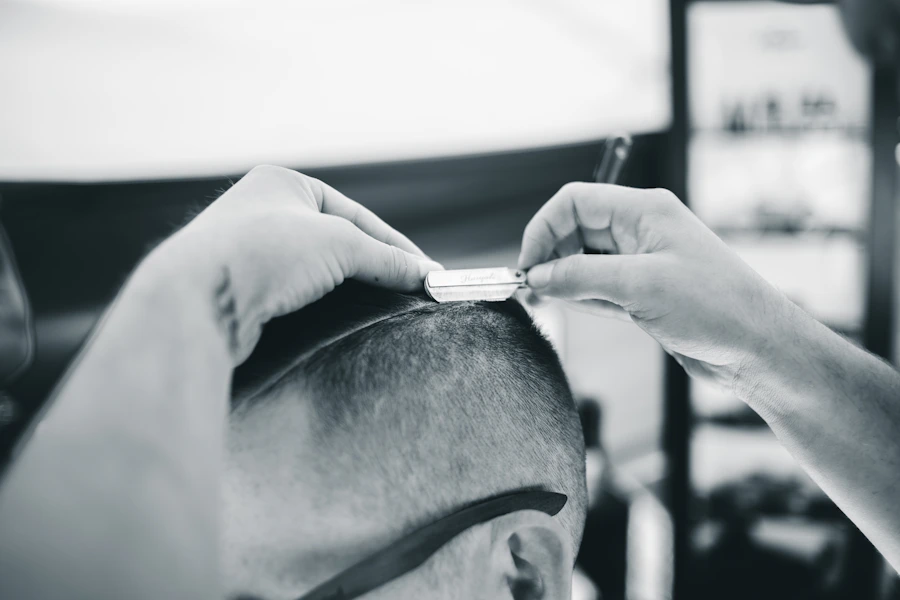 DHI Hair Transplant editorial image