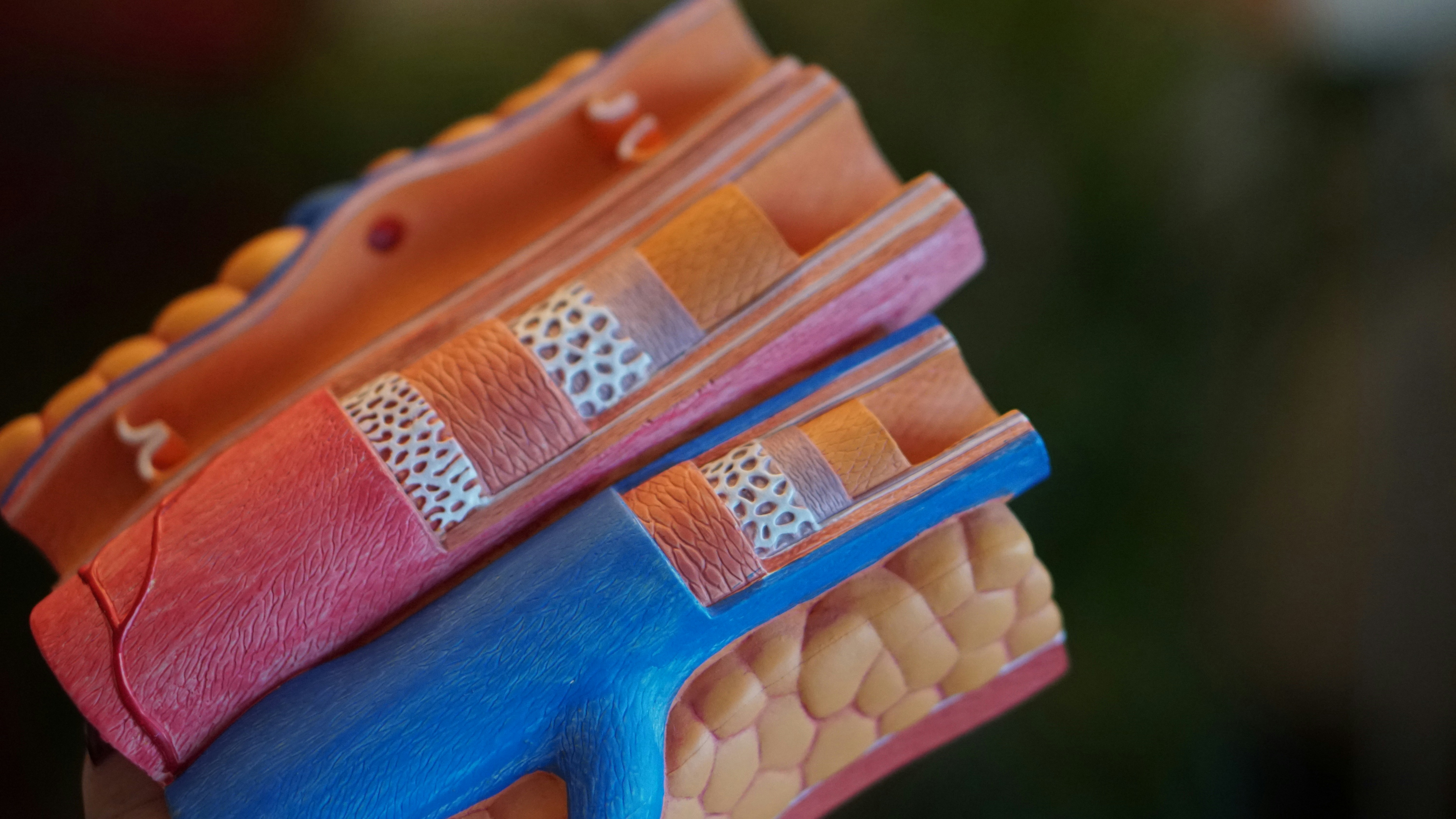 How Oxalates Affect Connective Tissue Disorders: The Ultimate Guide