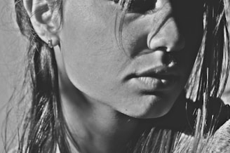 Before and after images showing the transformation of a client's chin area with precise hair removal.