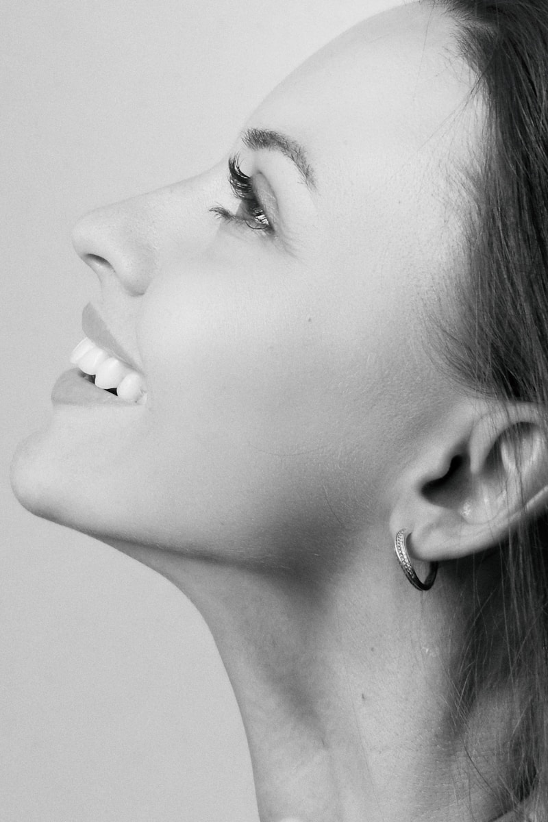 Perfiloplastia