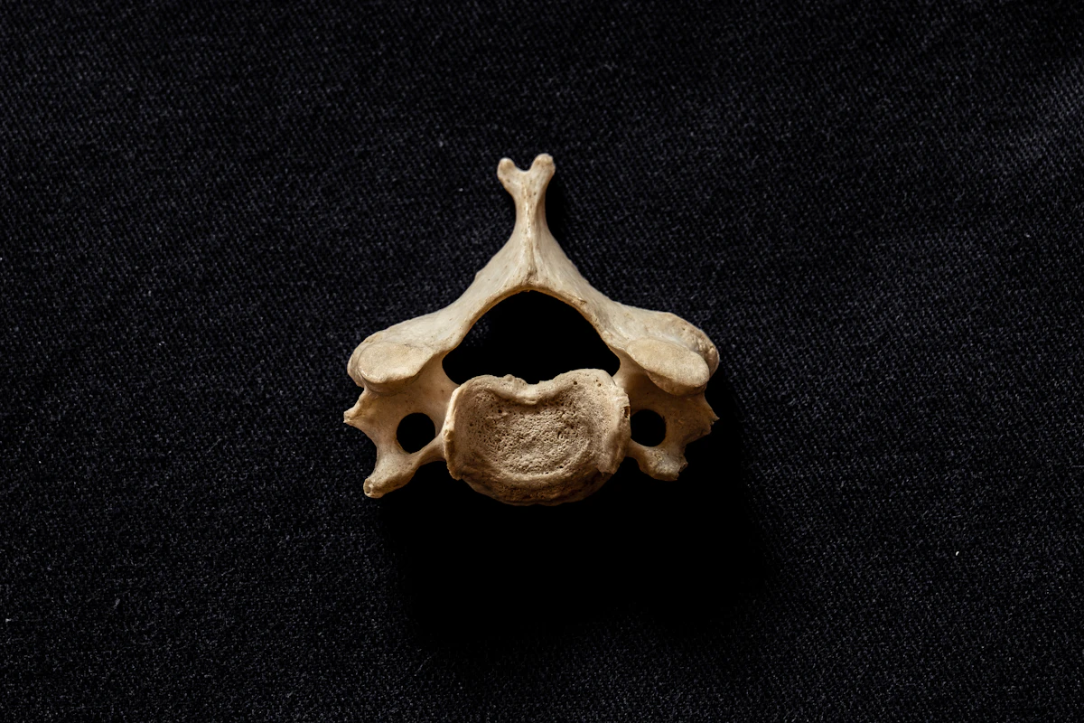 Why Chiropractors Outgrow the Front-Desk Review Ask in 2026