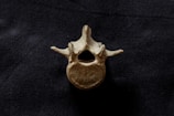 A single vertebra bone is placed against a dark, textured background. The bone has a central hole and two protruding structures on either side, displaying a natural, aged patina.