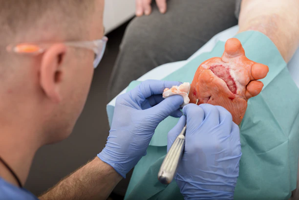 Close-up of a doctor examining a diabetic patient's foot with medical instruments in a clinical setting.
