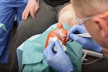 A medical professional wearing blue gloves is performing a procedure on a wounded hand. The hand appears to have a significant injury, and the professional is using tools to attend to it. The patient is seated, and surgical drapes cover parts of the hand and surrounding area.