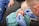 A medical professional wearing blue gloves is performing a procedure on a wounded hand. The hand appears to have a significant injury, and the professional is using tools to attend to it. The patient is seated, and surgical drapes cover parts of the hand and surrounding area.