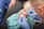 A medical professional wearing blue gloves is performing a procedure on a wounded hand. The hand appears to have a significant injury, and the professional is using tools to attend to it. The patient is seated, and surgical drapes cover parts of the hand and surrounding area.