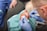 A medical professional wearing blue gloves is performing a procedure on a wounded hand. The hand appears to have a significant injury, and the professional is using tools to attend to it. The patient is seated, and surgical drapes cover parts of the hand and surrounding area.