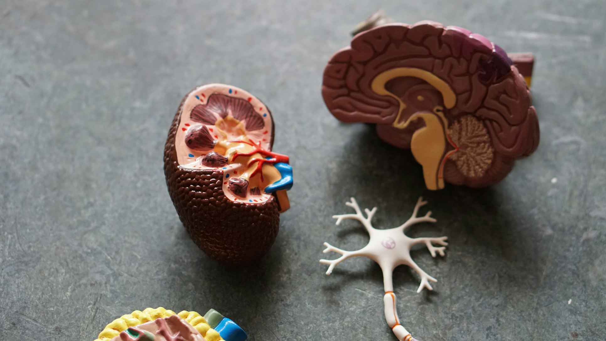 A Kidney Model, among other organs.