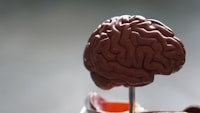 Diagnostic Accuracy