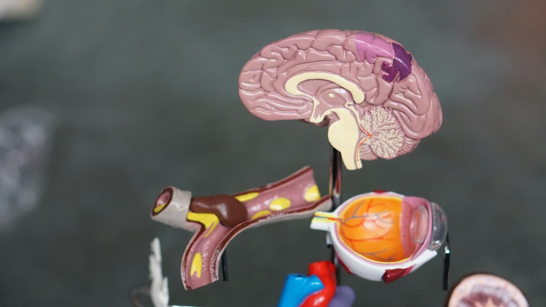 Medical brain illustration showing the neurological regions affected by Alzheimer's disease including the hippocampus and prefrontal cortex