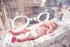 baby lying in incubator