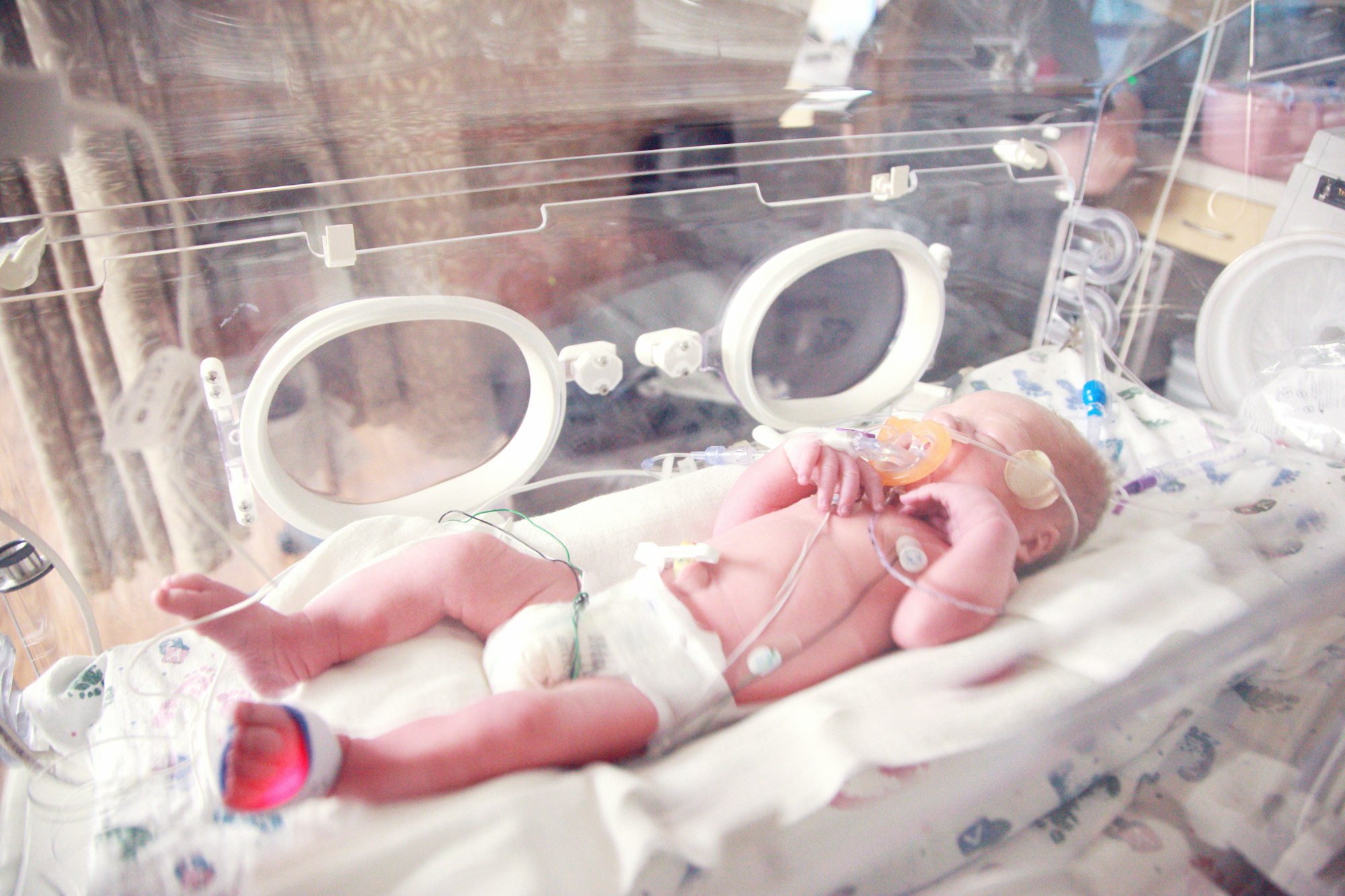 Hospitalisation du bébé dès sa naissance