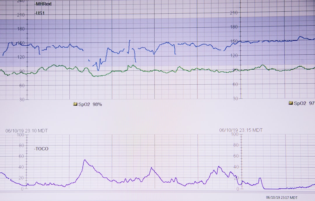 Electronic fetal monitor showing the baby's heart rate (top blue), mother's heart rate (middle green), and labor contractions (bottom purple). Baby was born exactly 40 minutes later!