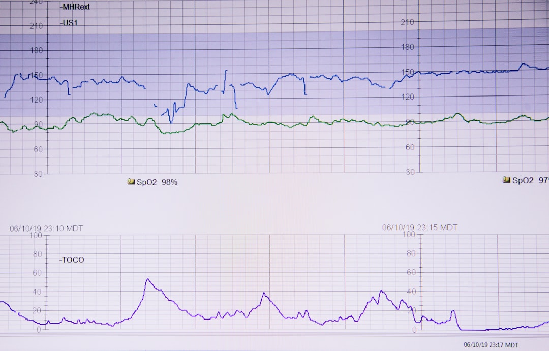 lifeline on white paper, Electronic fetal monitor showing the baby