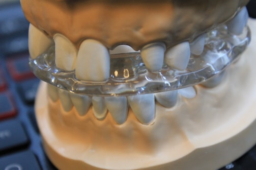 A close-up view of a dental model showcasing upper and lower sets of teeth with a transparent aligner placed between them. The model rests on a dark surface that appears to be part of a keyboard.