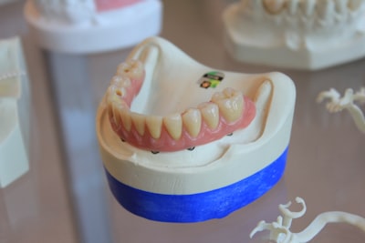 Full-arch implant-supported prosthesis on a dental lab model