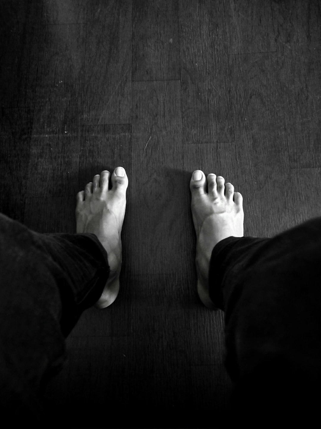 Foot Corn Removal – Bottom of Foot Callus Removal