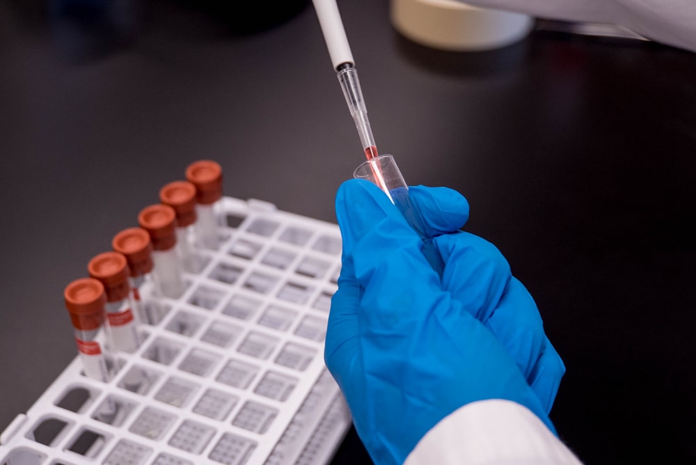 person holding test tube