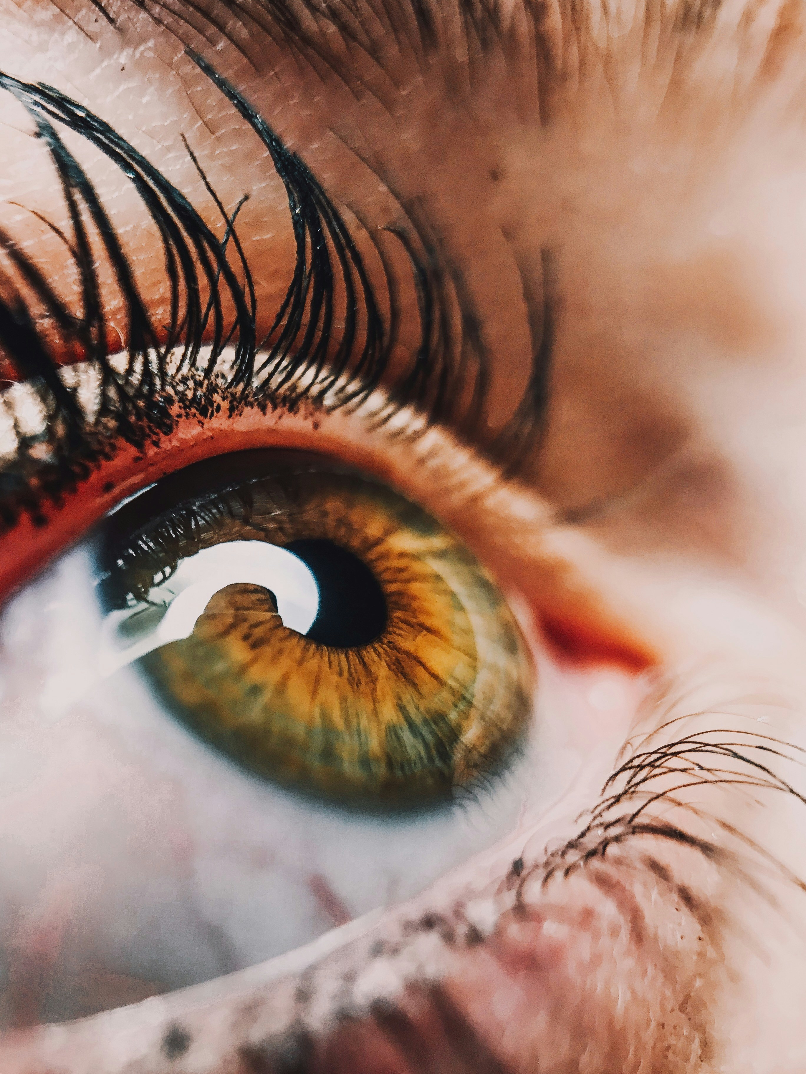 AI Updates Eye Exam