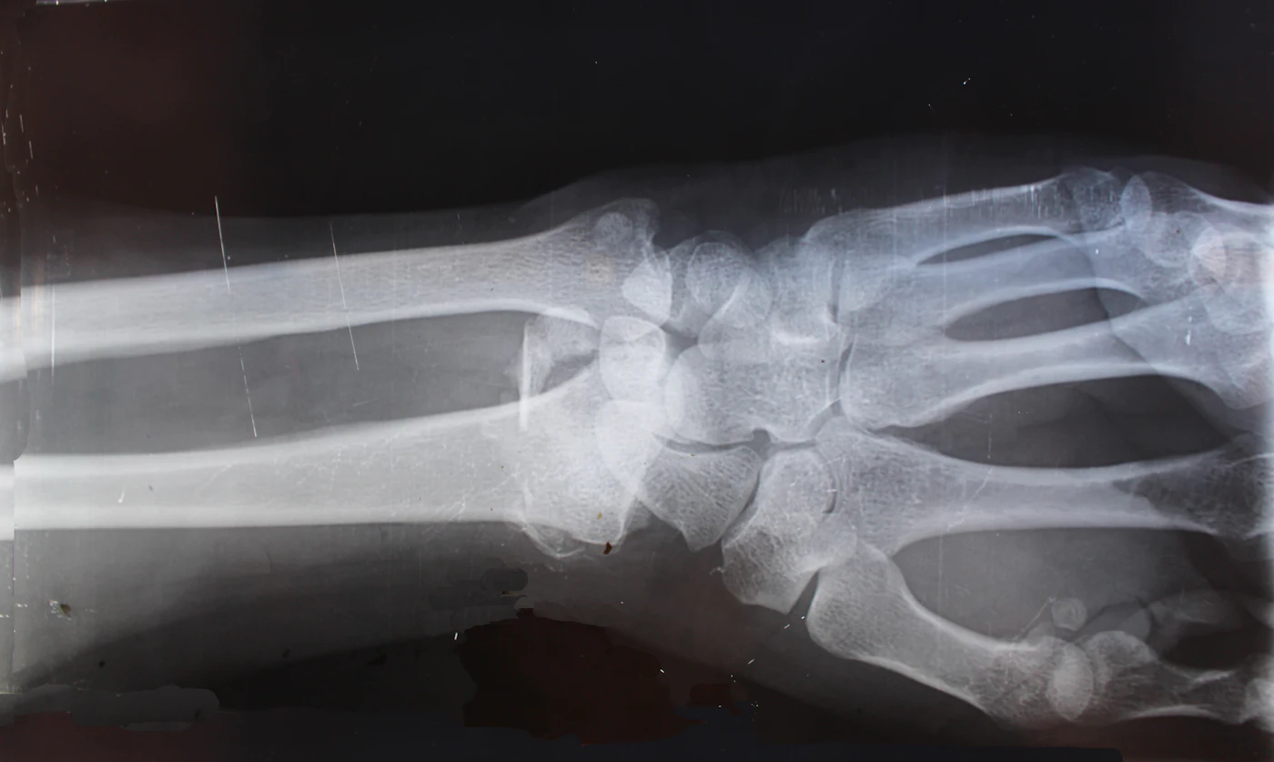 Radiografia sendo analisada em tela