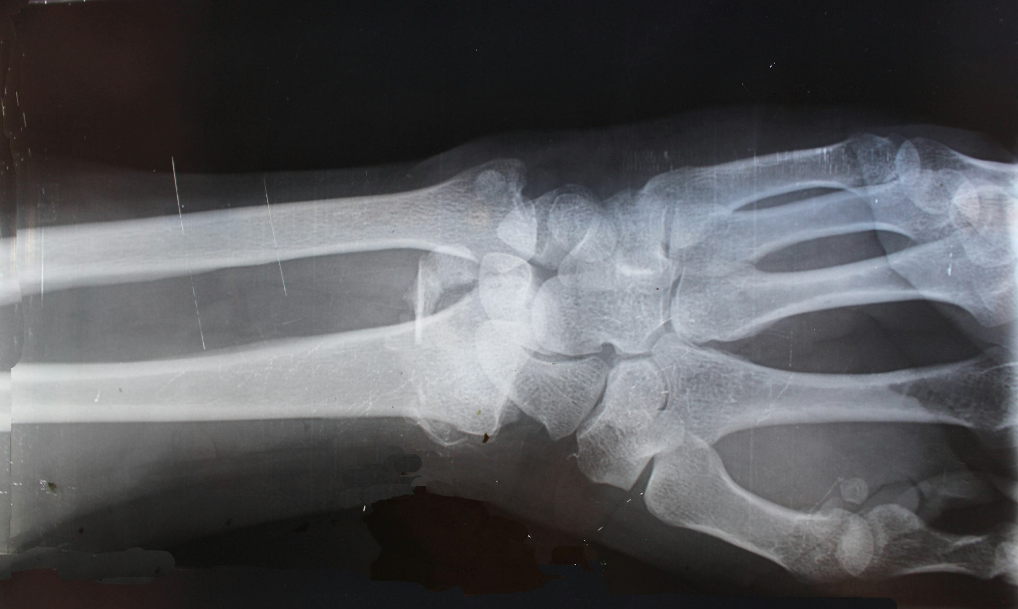 ИИ X-Raydar научился диагностировать рентгеновские снимки лучше, чем врачи